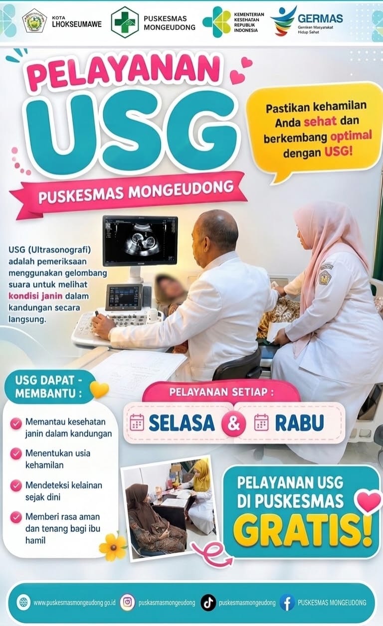 USG